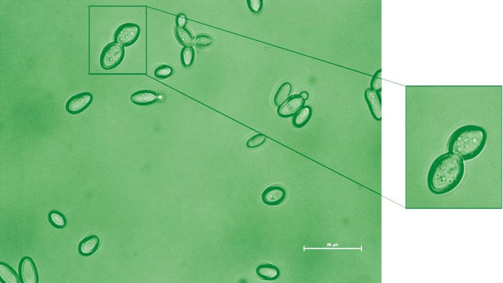Kazachstania weizmannii, a new species of yeast, could fight off Candida albicans infections. Photo courtesy of the Weizmann Institute of Science